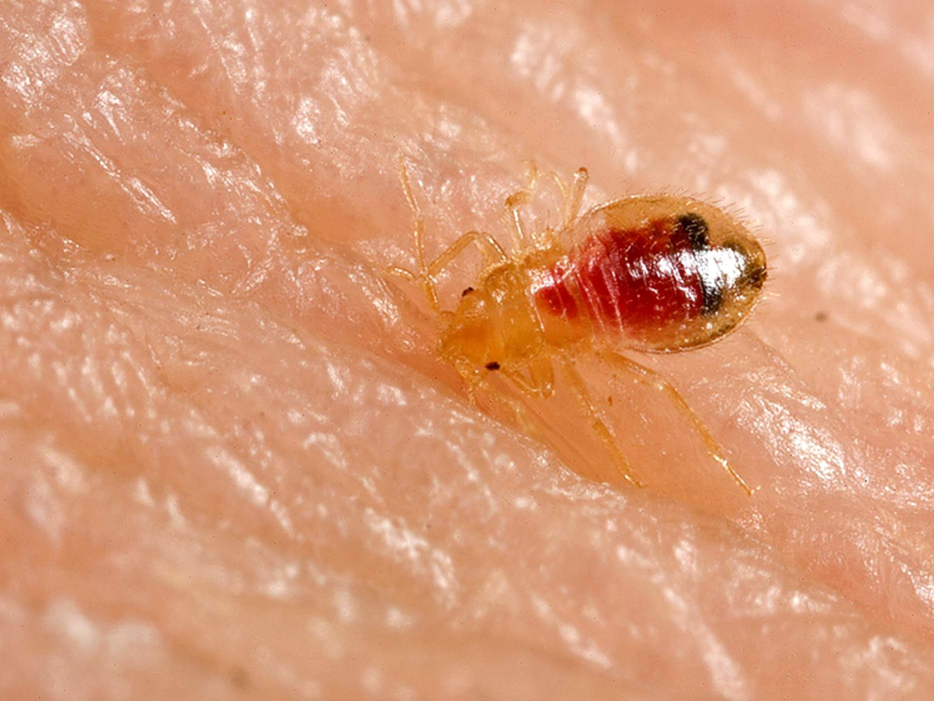 a close-up shot of a bed bug on skin